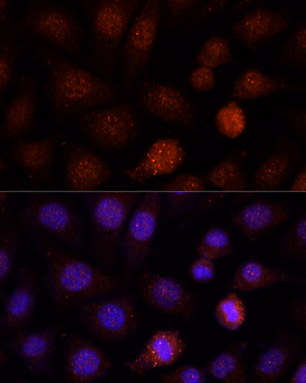 Immunofluorescence - PCGF1 Polyclonal Antibody 