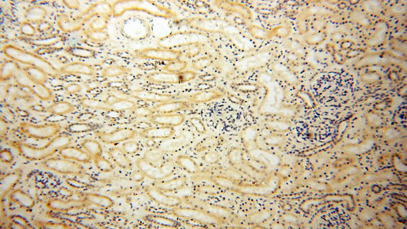Immunohistochemical of paraffin-embedded human kidney using Catalog No:112848(MRPS21 antibody) at dilution of 1:100 (under 10x lens)