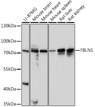 Western blot - FBLN1 Polyclonal Antibody 