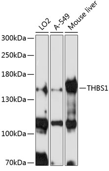 Western blot - THBS1 Polyclonal Antibody 