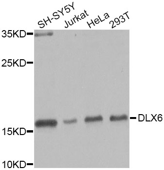 Western blot - DLX6 Polyclonal Antibody 