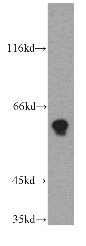HepG2 cells were subjected to SDS PAGE followed by western blot with Catalog No:116221(TPTE antibody) at dilution of 1:500