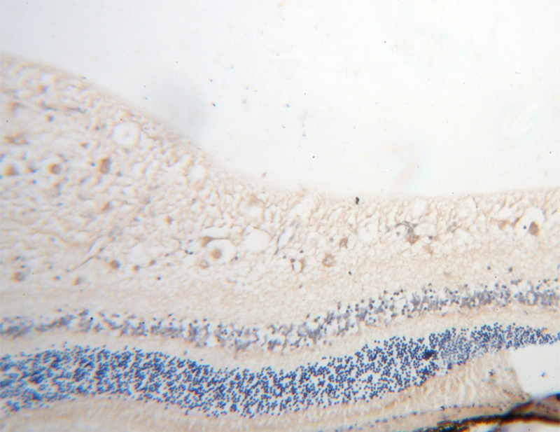 Immunohistochemical of paraffin-embedded human eye using Catalog No:111979(KCNS2 antibody) at dilution of 1:100 (under 10x lens)
