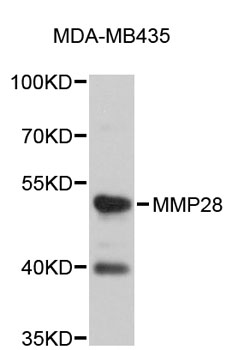 Western blot - MMP28 Polyclonal Antibody 