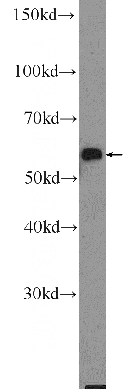 mouse skin tissue were subjected to SDS PAGE followed by western blot with Catalog No:111474(HMCN1 Antibody) at dilution of 1:1000