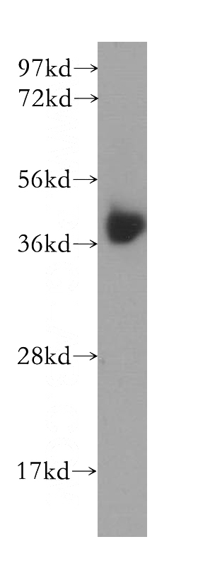 MCF7 cells were subjected to SDS PAGE followed by western blot with Catalog No:108397(B4GALT7 antibody) at dilution of 1:500