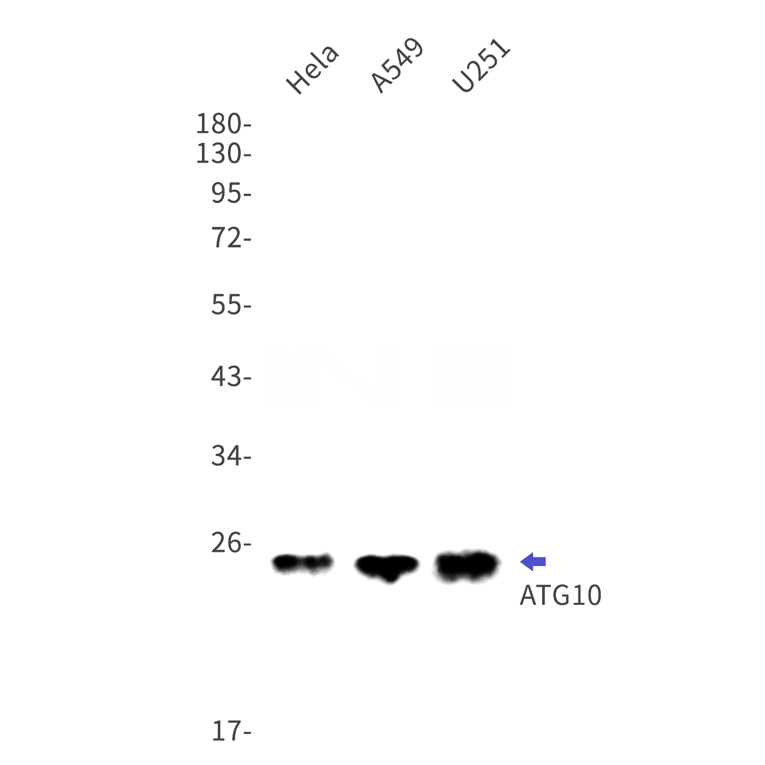 Western blot detection of ATG10 in Hela,A549,U251 cell lysates using ATG10 Rabbit mAb(1:1000 diluted).Predicted band size:25kDa.Observed band size:25kDa.