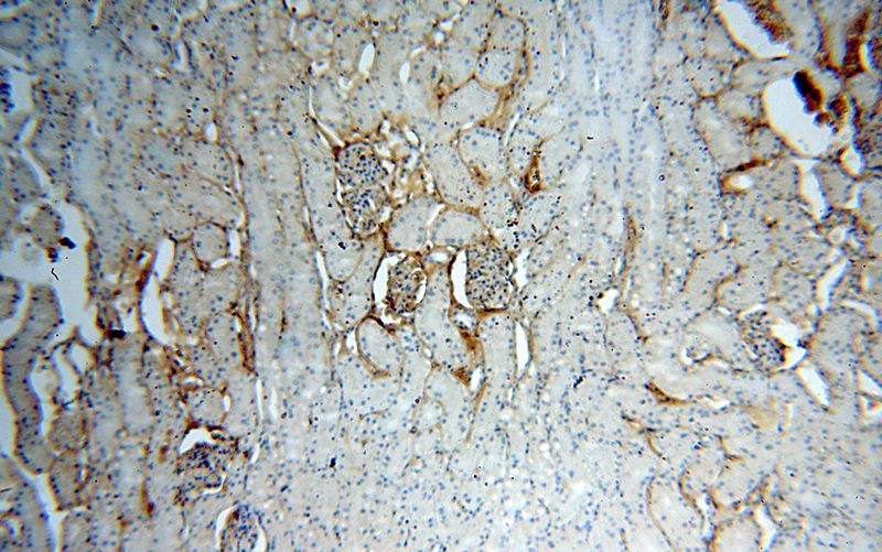 Immunohistochemical of paraffin-embedded human kidney using Catalog No:111633(IGSF11 antibody) at dilution of 1:50 (under 10x lens)