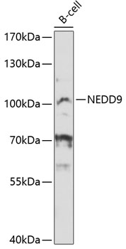 Western blot - NEDD9 Polyclonal Antibody 