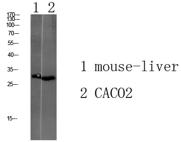 Fig1:; Western blot analysis of various lysate, antibody was diluted at 1000. Secondary antibody（catalog#：HA1001) was diluted at 1:20000