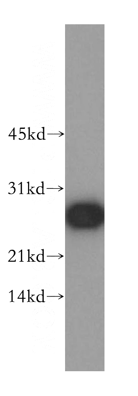 A549 cells were subjected to SDS PAGE followed by western blot with Catalog No:114178(PRDX6 antibody) at dilution of 1:500