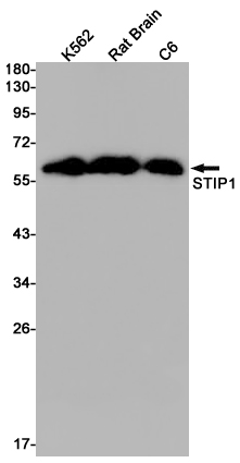 Western blot detection of STIP1 in K562,Rat Brain,C6 cell lysates using STIP1 Rabbit pAb(1:1000 diluted).Predicted band size:63kDa.Observed band size:63kDa.