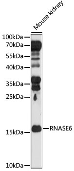 Western blot - RNASE6 Polyclonal Antibody 