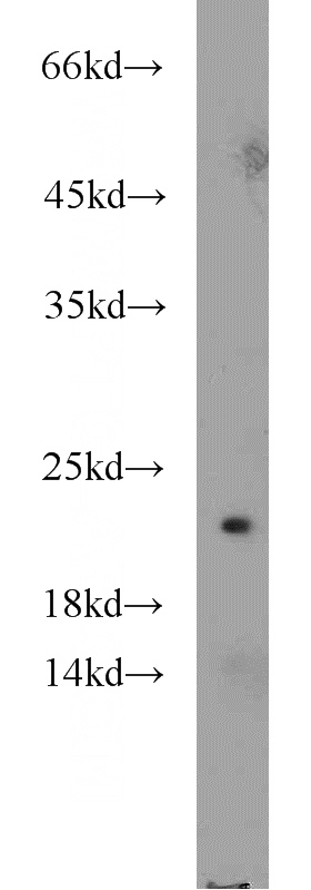 mouse kidney tissue were subjected to SDS PAGE followed by western blot with Catalog No:110113(DUS4L antibody) at dilution of 1:1000