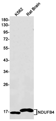 Western blot detection of NDUFB4 in K562,Rat Brain lysates using NDUFB4 Rabbit mAb(1:1000 diluted).Predicted band size:15kDa.Observed band size:15kDa.