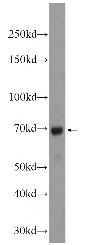HeLa cells were subjected to SDS PAGE followed by western blot with Catalog No:112872(MSL1 Antibody) at dilution of 1:600