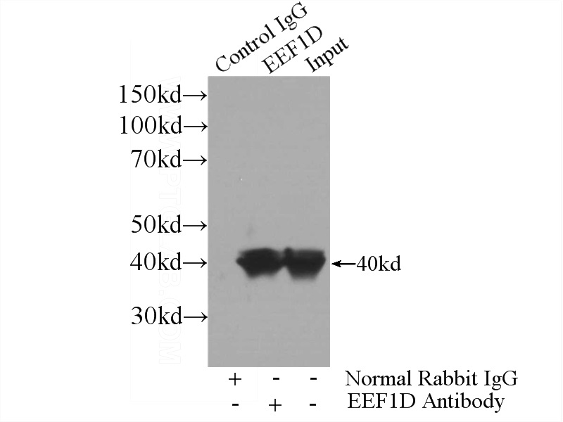 IP Result of anti-EEF1D (IP:Catalog No:110314, 3ug; Detection:Catalog No:110314 1:300) with HeLa cells lysate 1200ug.
