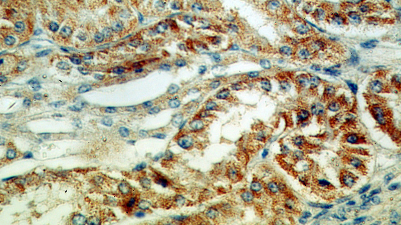 Immunohistochemical of paraffin-embedded human kidney using Catalog No:112689(MLYCD antibody) at dilution of 1:50 (under 40x lens)