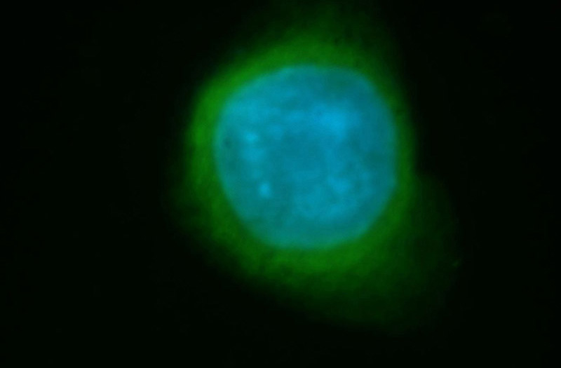 Immunofluorescent analysis of SH-SY5Y cells, using CDKN2A antibody Catalog No:113538 at 1:50 dilution and FITC-labeled donkey anti-rabbit IgG(green). Blue pseudocolor = DAPI (fluorescent DNA dye).