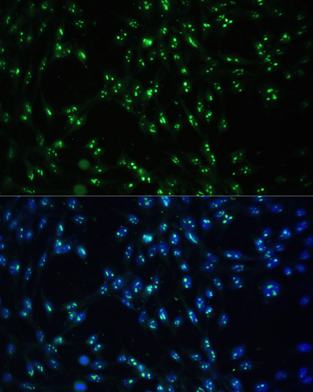 Immunofluorescence - CCDC59 Polyclonal Antibody 