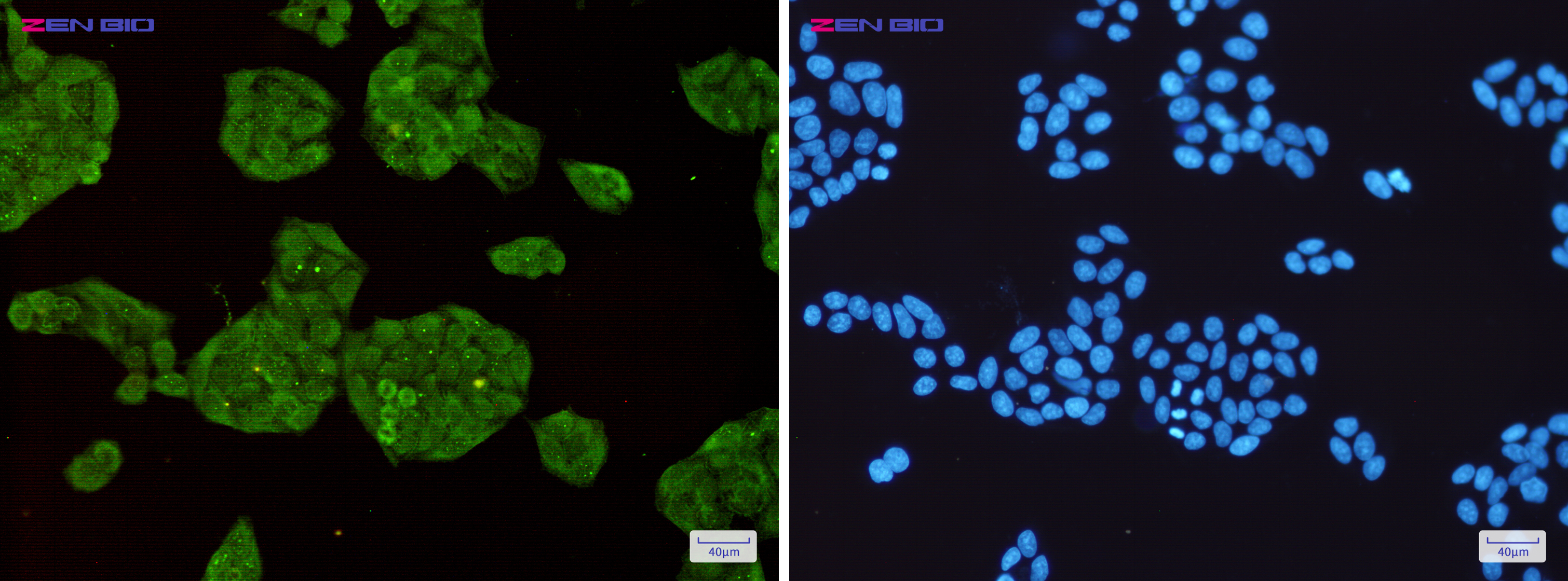 Immunocytochemistry of STUB1(green) in Hela cells using STUB1 Rabbit mAb at dilution 1/50, and DAPI(blue)