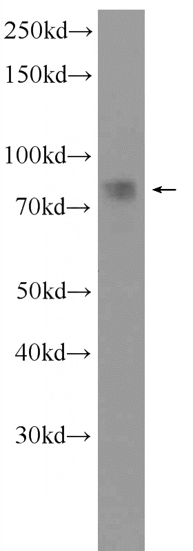 fetal human brain tissue were subjected to SDS PAGE followed by western blot with Catalog No:109316(CIN85 Antibody) at dilution of 1:1000