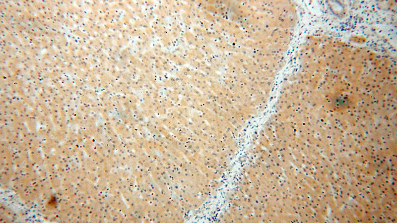 Immunohistochemical of paraffin-embedded human liver using Catalog No:112050(KIF6 antibody) at dilution of 1:50 (under 10x lens)