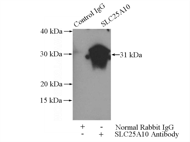 IP Result of anti-SLC25A10 (IP:Catalog No:115321, 3ug; Detection:Catalog No:115321 1:500) with mouse liver tissue lysate 4000ug.