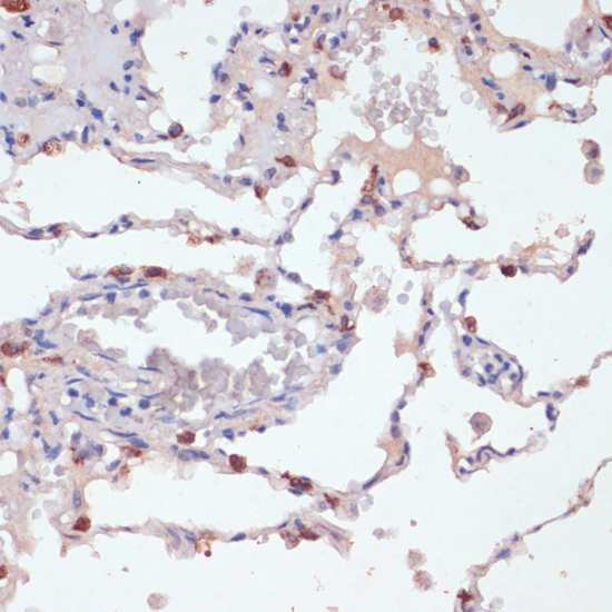 Immunohistochemistry - SFTPC Polyclonal Antibody 