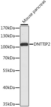 Western blot - DNTTIP2 Polyclonal Antibody 