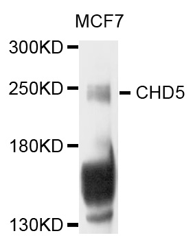 Western blot - CHD5 Polyclonal Antibody 