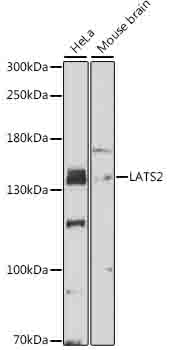 Western blot - LATS2 Polyclonal Antibody 