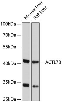 Western blot - ACTL7B Polyclonal Antibody 