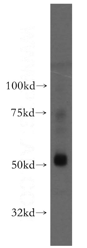 human liver tissue were subjected to SDS PAGE followed by western blot with Catalog No:107799(ADPGK antibody) at dilution of 1:500