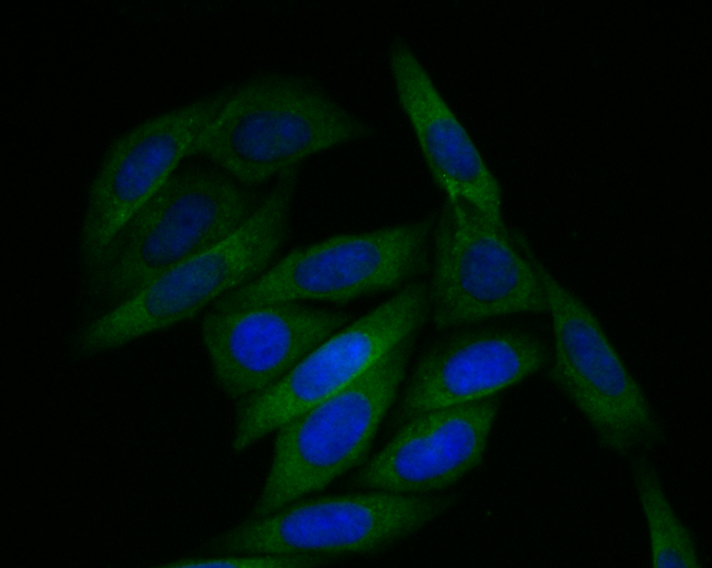 Fig4: ICC staining Tmem248 in SiHa cells (green). The nuclear counter stain is DAPI (blue). Cells were fixed in paraformaldehyde, permeabilised with 0.25% Triton X100/PBS.