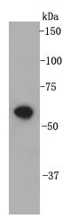 Fig1: Western blot analysis on cell lysates using anti- CD332 rabbit polyclonal antibodies.