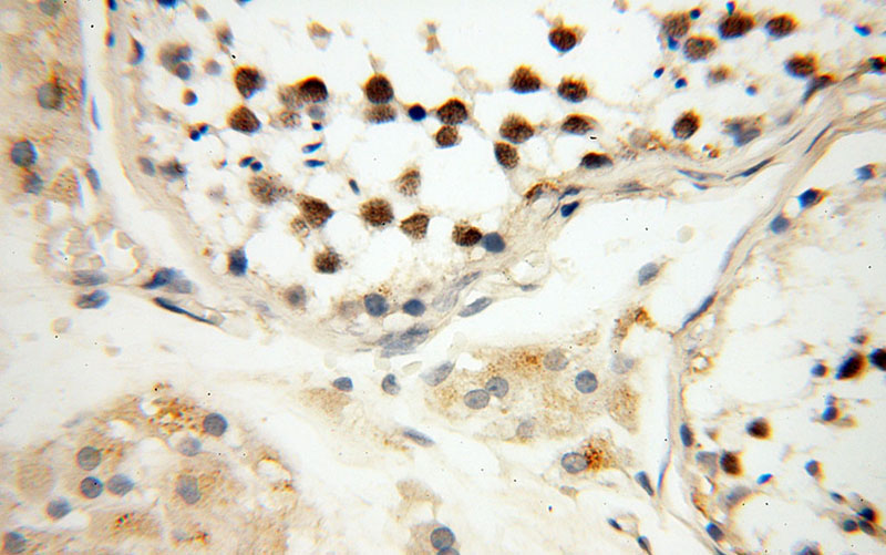 Immunohistochemical of paraffin-embedded human testis using Catalog No:115957(TEX12 antibody) at dilution of 1:100 (under 40x lens)