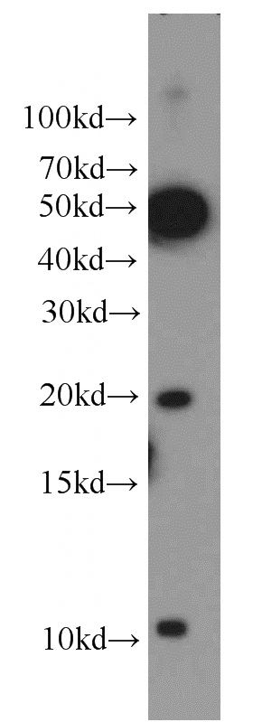 PC-3 cells were subjected to SDS PAGE followed by western blot with Catalog No:111598(ID1 antibody) at dilution of 1:500