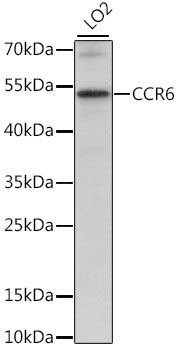 Western blot - CCR6 Polyclonal Antibody 