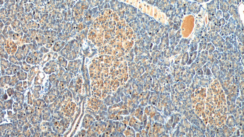 Immunohistochemistry of paraffin-embedded human pancreas tissue slide using Catalog No:108996(CCK Antibody) at dilution of 1:200 (under 10x lens).
