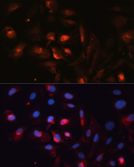 Immunofluorescence - AQP5 Polyclonal Antibody 