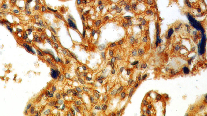 Immunohistochemical of paraffin-embedded human placenta using Catalog No:111116(GPR161 antibody) at dilution of 1:50 (under 40x lens)