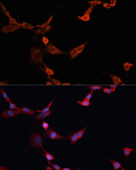 Immunofluorescence - INPP5D Polyclonal Antibody 