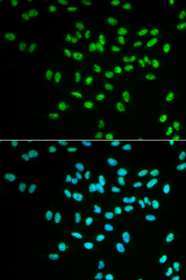 Immunofluorescence - FANCD2 Polyclonal Antibody 