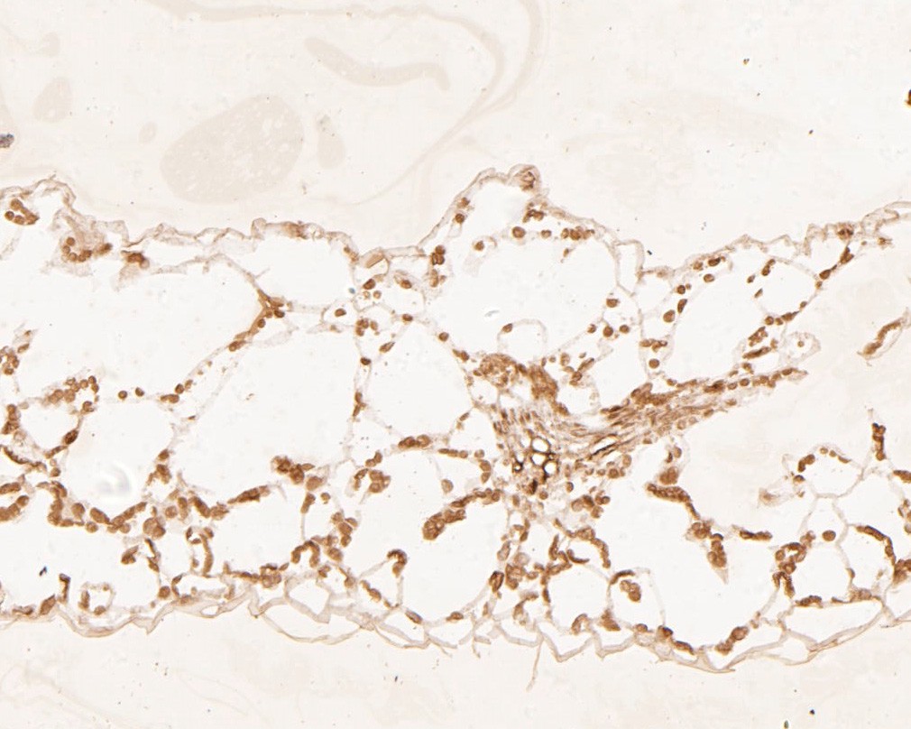 Fig2:; Immunohistochemical analysis of paraffin-embedded A. thaliana; tissue using anti-HDG11 antibody. The section was pre-treated using heat mediated antigen retrieval with sodium citrate buffer (pH 6.0) for 20 minutes. The tissues were blocked in 5% BSA for 30 minutes at room temperature, washed with ddH; 2; O and PBS, and then probed with the primary antibody ( 1/50) for 30 minutes at room temperature. The detection was performed using an HRP conjugated compact polymer system. DAB was used as the chromogen. Tissues were counterstained with hematoxylin and mounted with DPX.