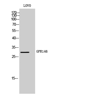 Fig1:; Western Blot analysis of LOVO cells using GPR146 Polyclonal Antibody