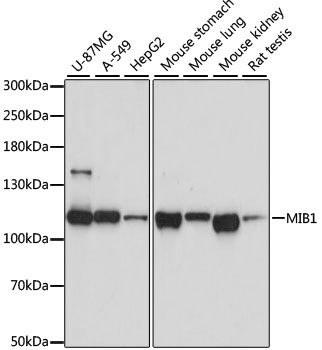 Western blot - MIB1 Polyclonal Antibody 