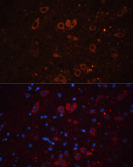 Immunofluorescence - SLC17A7 Polyclonal Antibody 