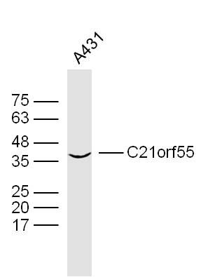 Fig1: Sample: A431 Cell (Human) Lysate at 40 ug; Primary: Anti-C21orf55 at 1/300 dilution; Secondary: IRDye800CW Goat Anti-Rabbit IgG at 1/20000 dilution; Predicted band size: 46 kD; Observed band size: 43 kD