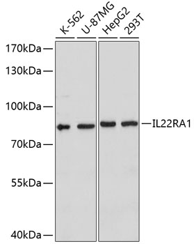 Western blot - IL22RA1 Polyclonal Antibody 